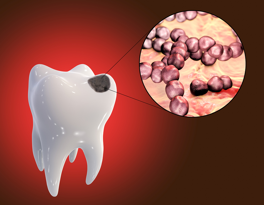 Streptococcus mutans